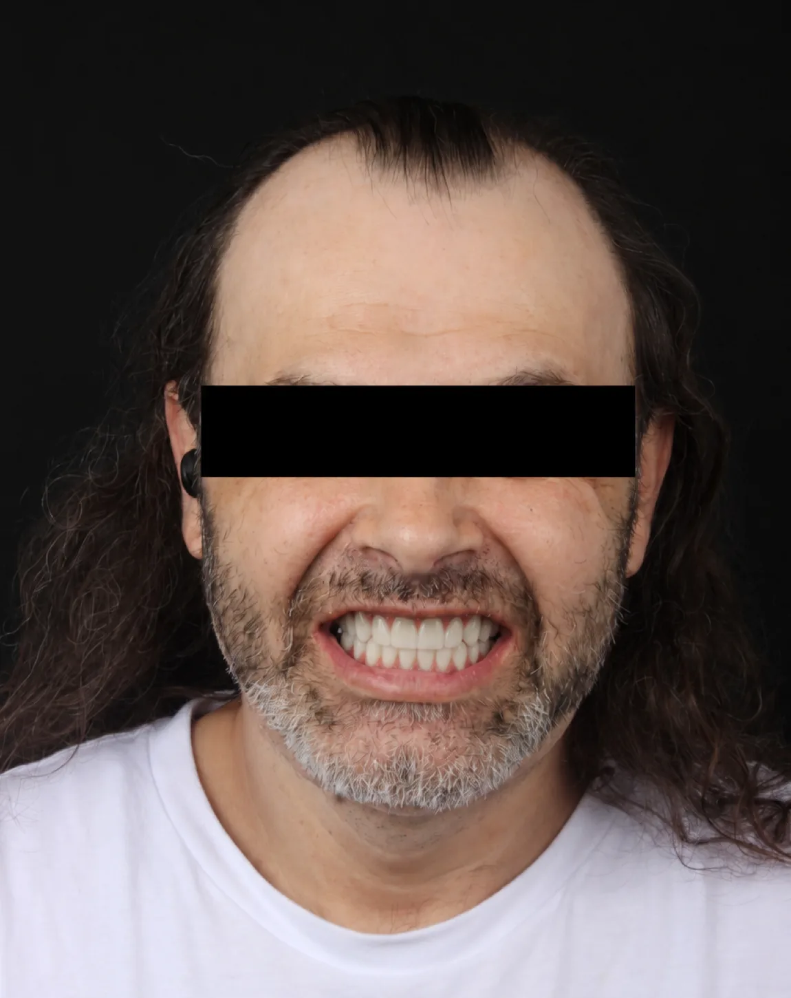 Patient 03 after treatment