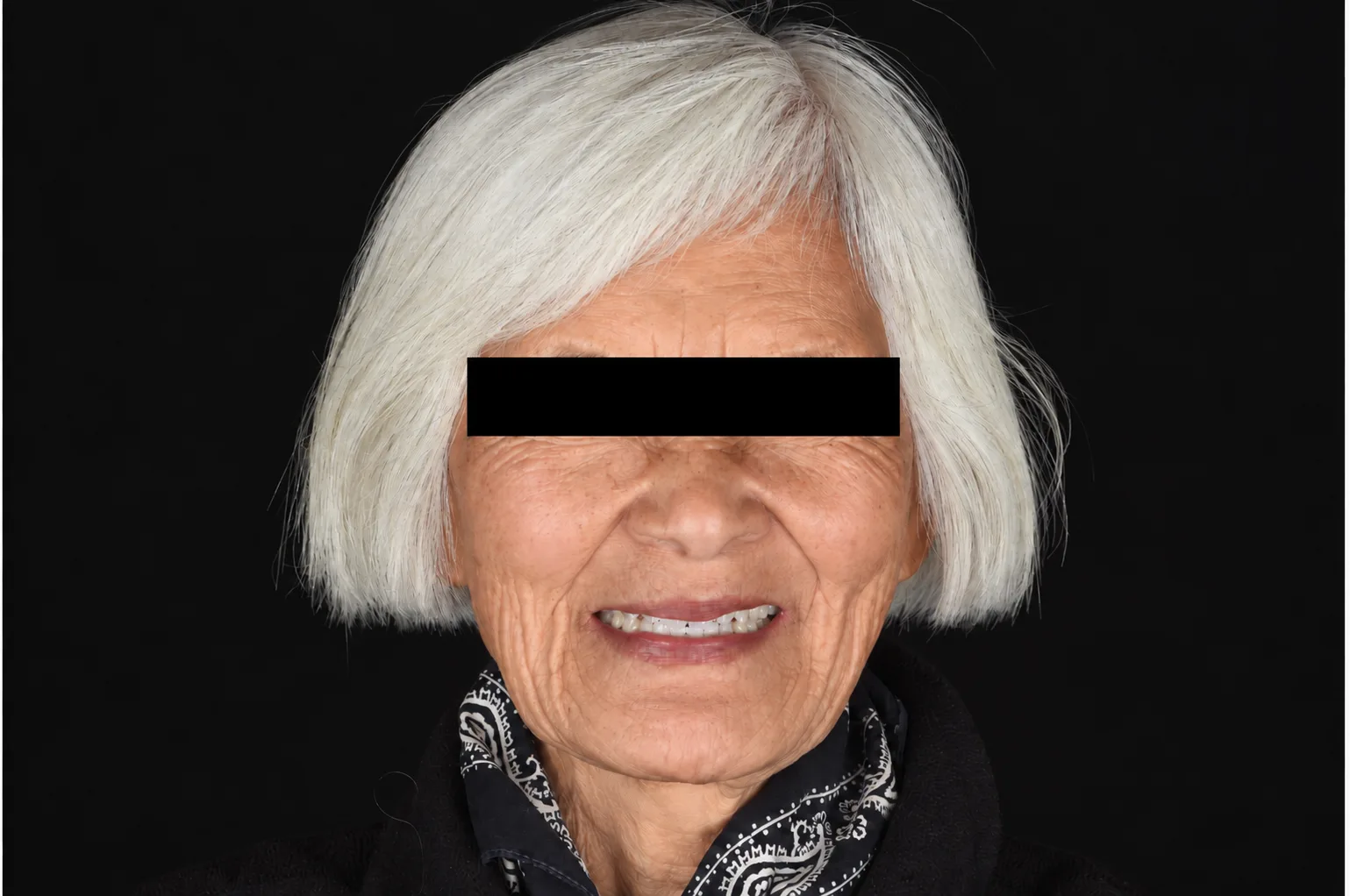 Case 01 patient after treatment